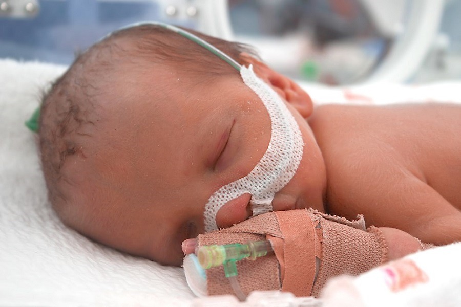 Baby in the NICU